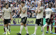 Nguy cơ mất 'Mad dog' lẫn Maguire, Man Utd lấy gì đấu Man City?