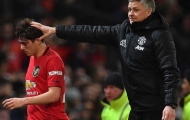 Thua đau, Solskjaer thừa nhận sự thật cay đắng về Man Utd