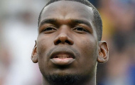 Pogba đang rất mơ hồ về chấn thương