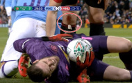 De Gea gục ngã, đội trưởng Maguire lộ rõ chấn thương đau đớn