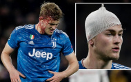 “Sự vắng mặt của De Ligt đã giúp Lyon đánh bại Juventus”