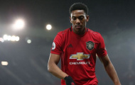 XONG! Solskjaer báo tin cực sốc về Martial, M.U gặp đại họa
