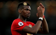 Vì sao Pogba chỉ có giá 50 triệu bảng?