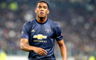 Anthony Martial nhận “cơn mưa lời khen” tại ĐT Pháp