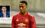 Anthony Martial nhận thẻ đỏ vì... Cavani?