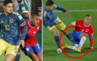 James Rodriguez thoát thẻ đỏ sau cú đạp triệt hạ Alexis Sanchez