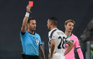 3 thẻ đỏ sau 7 trận, con số báo động cho Juventus!