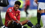 XONG! FA xác nhận chấn thương của Marcus Rashford