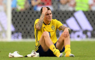Trợ lý HLV Thụy Điển lên tiếng về chấn thương của Victor Lindelof