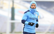 Lộ lý do Aguero vắng mặt ở trận Man City - Burnley
