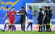 Sau tất cả, Welbeck đã lên tiếng về việc Liverpool bị thổi phạt đền