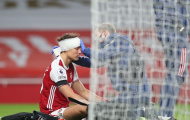 SỐC! Sao Arsenal băng đầu thi đấu, Arteta bị tố 'vô nhân đạo'
