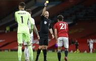 Tình huống Daniel James bị rút thẻ vàng khó hiểu