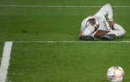 Choáng với số ca chấn thương của Real Madrid từ đầu mùa