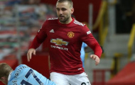 Thua 3 trận bán kết, Luke Shaw khẳng định sự thật đau lòng về Man Utd