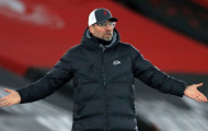 Liverpool kém 'may mắn' hơn Man United?