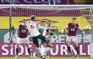 Biểu cảm khó đỡ của Martial khi Pogba sút tung lưới Burnley
