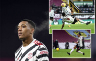 Martial ngả bàn đèn, bỏ lỡ 3 cơ hội ghi bàn cho Man Utd trận Bunrley