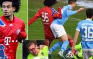 SỐC! Sao trẻ Bayern khiến mặt đối thủ đầy máu