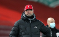 Thua M.U, Klopp thừa nhận một sự thật đau lòng về Liverpool