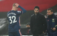 Arteta thừa nhận không thể làm 1 điều ở Arsenal
