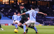 Pep cập nhật tình hình chấn thương của Gundogan