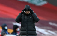 Liverpool thua Man City 16 điểm, Klopp phân trần