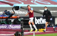 Khuôn mặt đẫm máu, sao West Ham vẫn cười toe toét
