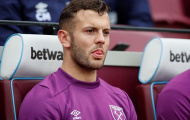 Jack Wikshere nêu điều tiếc nuối nhất ở Arsenal