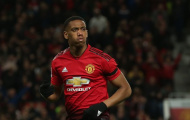 'Ngôn ngữ cơ thể của Martial khiến tôi cảm thấy sốc'