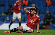 Hòa Chelsea thất vọng, Bruno bộc lộ rõ điểm yếu của Man Utd