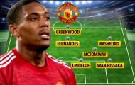 Cavani ngồi ngoài, Man United dùng quân xanh đấu Palace
