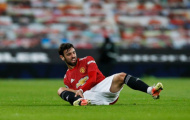 Bruno Fernandes: 'Ai đó suýt đã làm gãy mắt cá chân của tôi!'