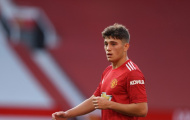 XONG! Man United nhận tin dữ trước trận tái đấu Roma