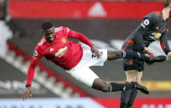 Đã rõ thiết bị Tuanzebe đeo ở trận Leicester
