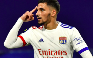 Quá tệ hại, Arsenal để vuột mất bản HĐ cực chất
