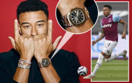 CHOÁNG! Jesse Lingard bị trộm trang sức đắt giá ngay lúc đang thi đấu