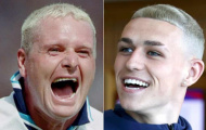 ĐT Anh trông thế nào nếu toàn bộ thành viên cắt tóc Gascoigne?