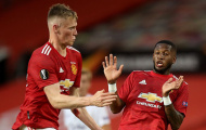 Máy quét báo hung tin cho Man Utd