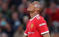 Giải cứu Martial, đối tác đổi máy quét chất lượng cho Man Utd
