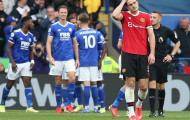 Brendan Rodgers hé lộ cho Klopp cách đánh bại Man Utd vào cuối tuần