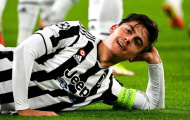 Dybala giải thích lý do 'cosplay' Platini