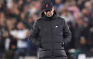 Jurgen Klopp và 5 vấn đề ảnh hưởng đến khả năng cạnh tranh chức vô địch