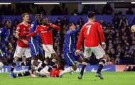 Nguy cho Rangnick, Man Utd có thể mất tới 8 cầu thủ ở trận tới