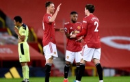 Bốn thay đổi Man Utd phải thực hiện trước Burnley