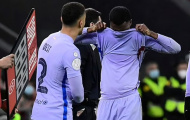 Thần đồng Barca đang sợ chấn thương hơn bao giờ hết