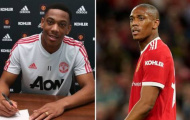 2 điều khoản chưa kích hoạt trong hợp đồng của Martial với Man Utd
