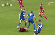 Klopp phá vỡ im lặng về chấn thương của Luis Diaz