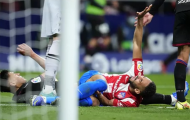 Atletico Madrid mất tiền đạo chủ lực cho lần đụng độ Man Utd
