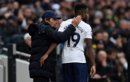 Conte xác nhận tổn thất trước đại chiến với Man Utd